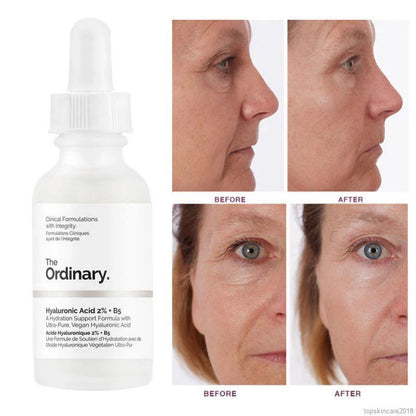 The Ordinary Hyaluronic Acid 2% + B5 60ml / 2 fl. oz.